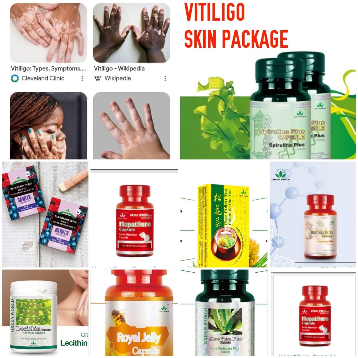 Vitiligo package